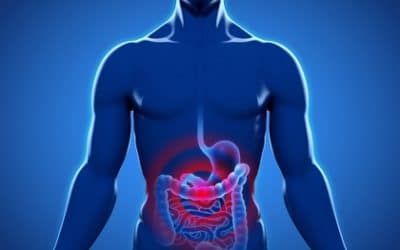 Áteresztő bél szindróma